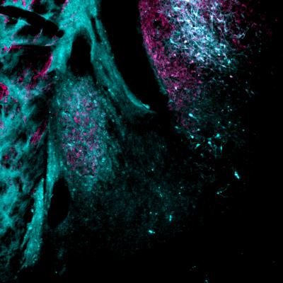 BNST Plays a Role in Stress and Anxiety