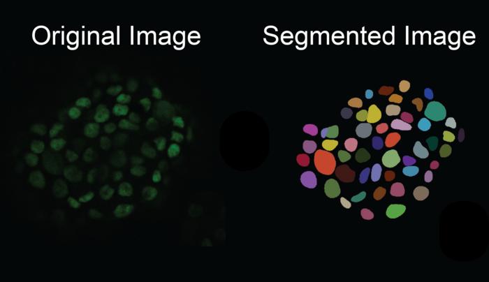 Cell segmentation