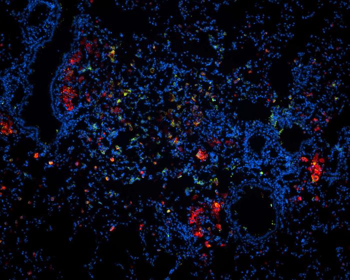 Tuberculosis Therapy: Smallest Particles Will Deliver the Drug to the Lungs in Future