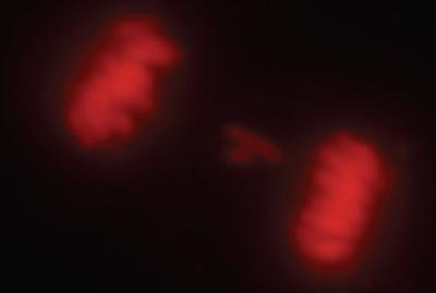 Cell Overexpressing UbcH10