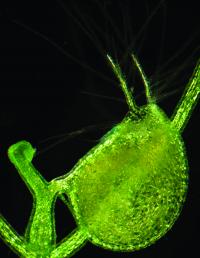 Light Micrograph of <i>Utricularia gibba</i>