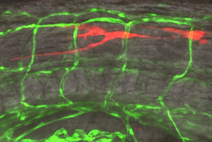 Cancer cell movement