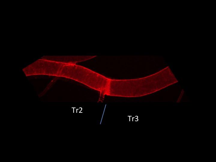 <em>Drosophila</em> Trachea