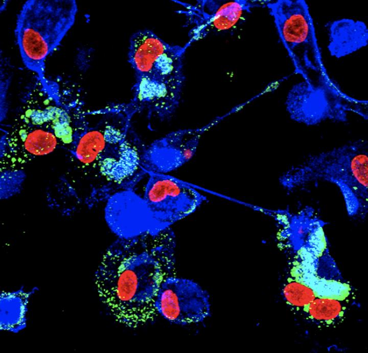 Ebola-infected macrophages and tunneling nanotubes