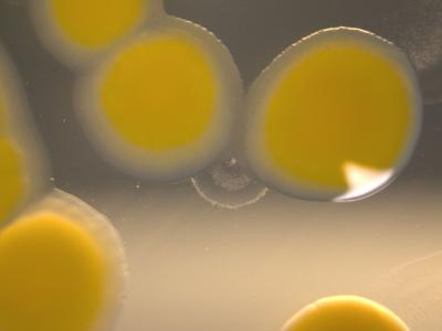 <i>Herbaspirillun sp.</i> Bacteria Isolated from the Stream System Located in Iceland