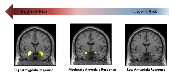 Amygdala Responses: High to Low