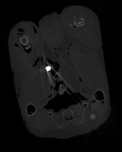 0.1mm thick CT section of pheasant