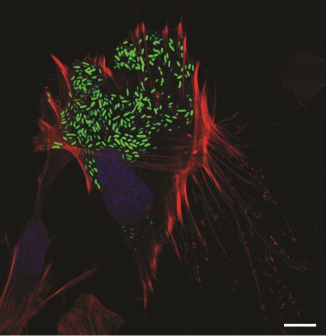 Vibrio Parahaemolyticus