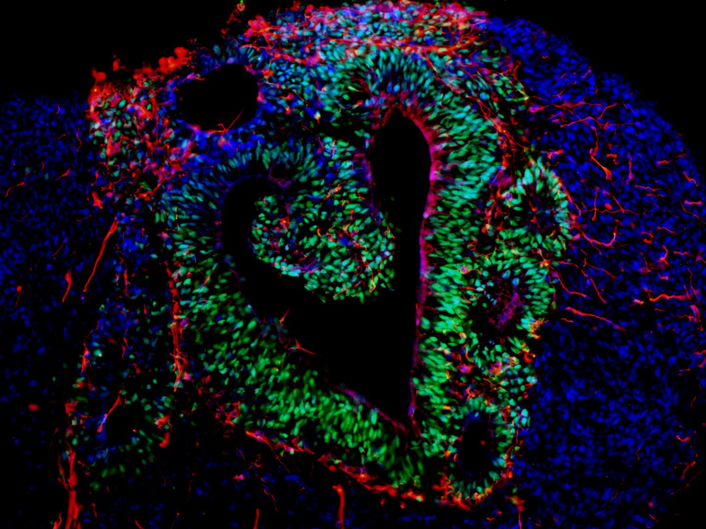 Brain Organoid