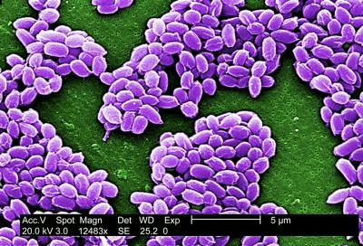 Anthrax Spores