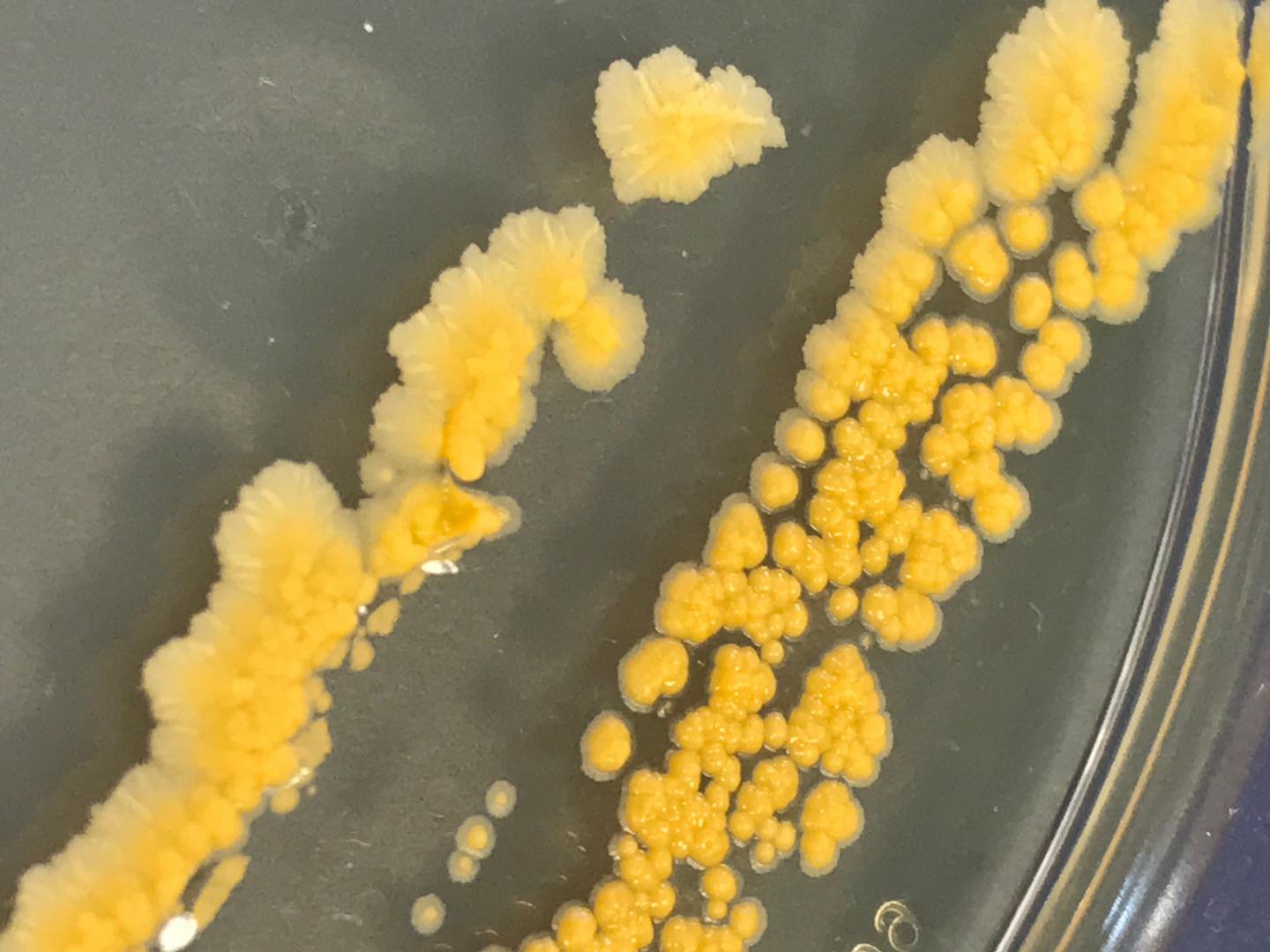 Bacteria Growing after Being Frozen