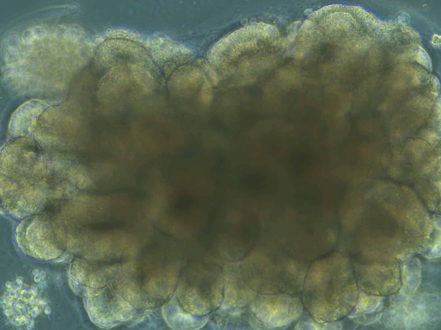 Organoid during Development