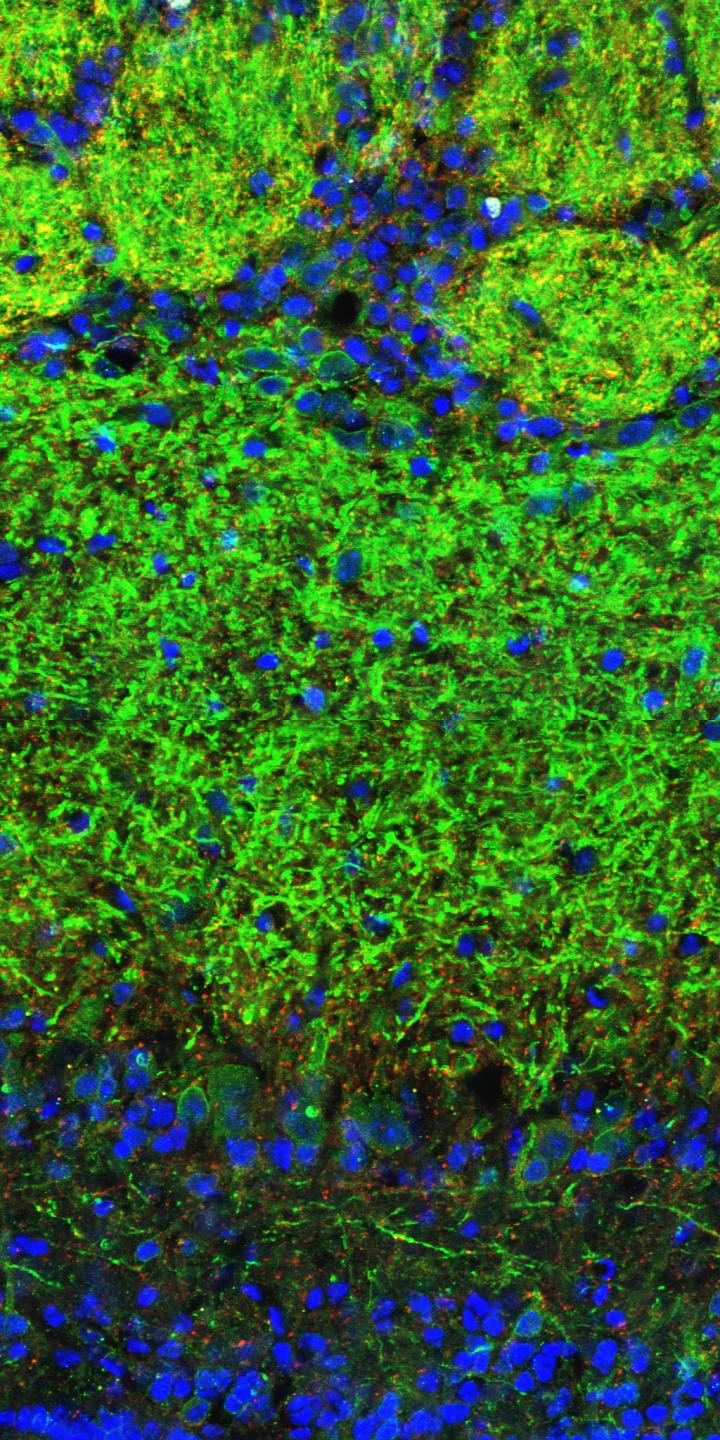 The Normal Mouse Bulbus Olfactorius under the Microscope