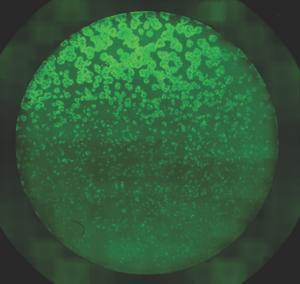 cell density patterns