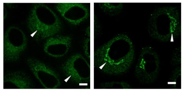 Figure 2. Images of Cells with USP8 (Left Panel) and without USP8 (Right Panel)