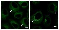 Figure 2. Images of Cells with USP8 (Left Panel) and without USP8 (Right Panel)