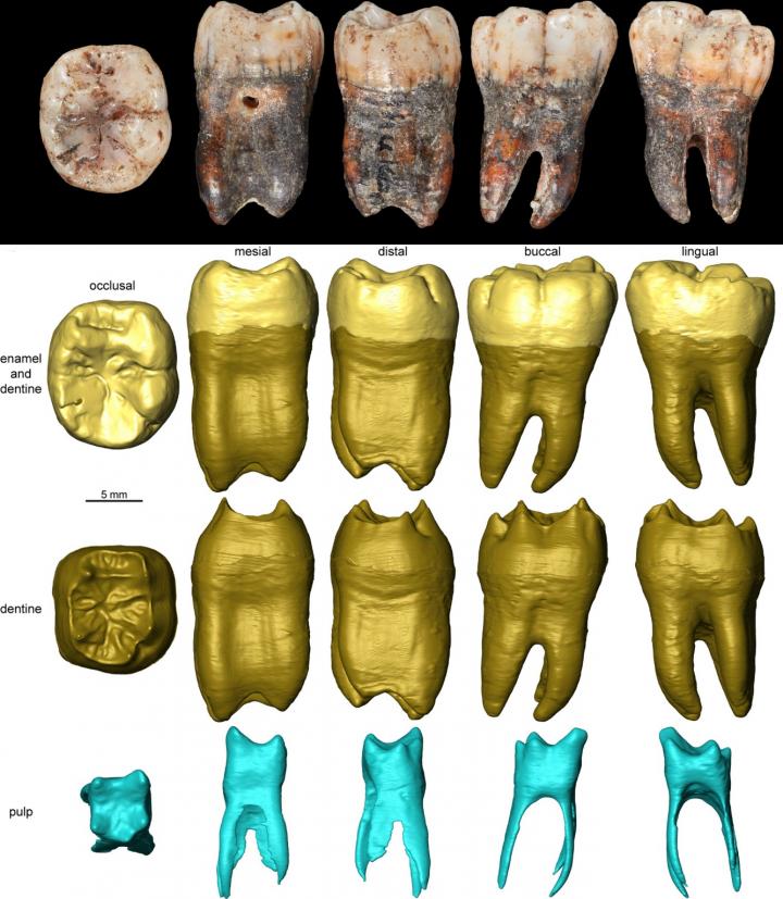 Neanderthal tooth