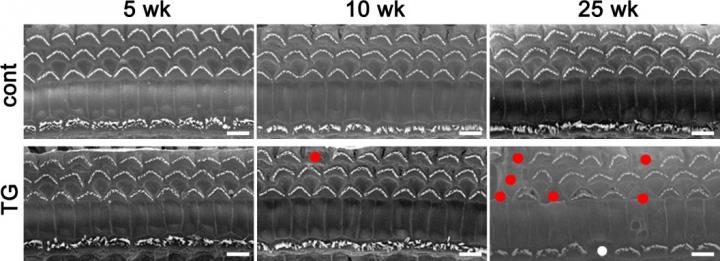 Electron Microscope Images of the Cochlea