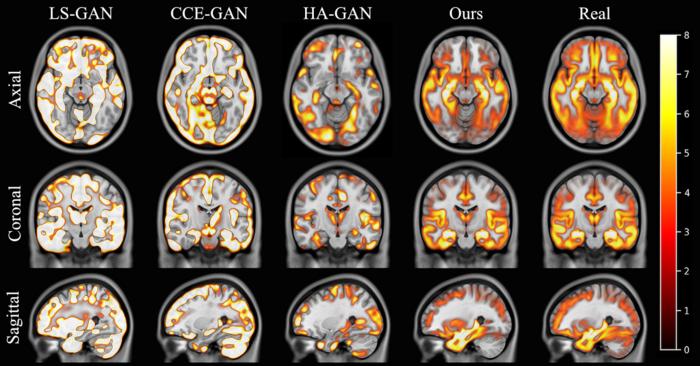 Brain images comparison