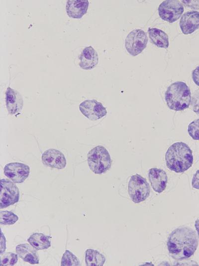 Appearance of Feline <i>Tritrichomonas</i> Species at x100 Magnification