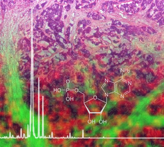 New Mass Spectrometry Imaging