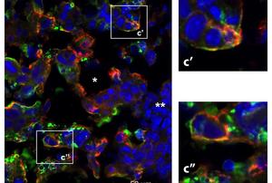 The maternal hormone-like cytokine XCL1 acts interacts with specific receptors (green) on the surface of specialized fetal placenta cells (red). c’, c’’ show specialized fetal cells with receptor expression (yellow).