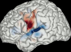 MAP OF AUDITORY COROLLARY DISCHARGE SIGNALS IN THE HUMAN BRAIN