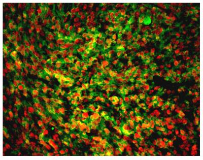Cerebellar Stem Cells