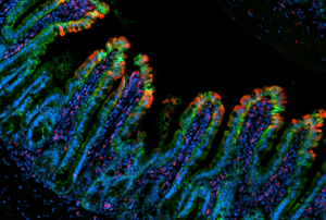 Image demonstrating TNF-driven intestinal inflammation, where the gut-lining epithelial cells