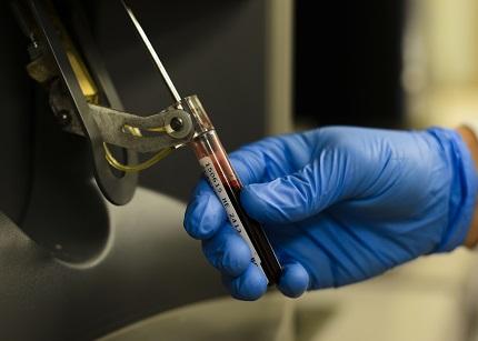 Improving HIV Care in Low- and Middle-Income Countries