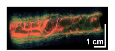 A Rabbit's Esophagus