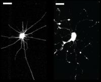 Healthy and Damanged Neurons