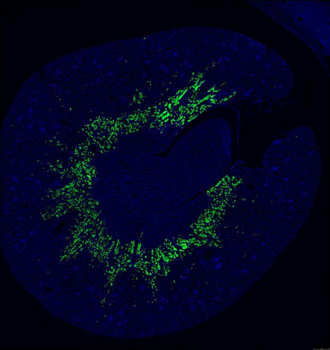 A cross-sectional view of the preclinical model’s kidney revealing that the omega-3 lysolipid transporter Mfsd2a (green color) is found specifically in the S3 segment of the proximal tubules