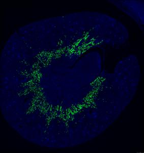 A cross-sectional view of the preclinical model’s kidney revealing that the omega-3 lysolipid transporter Mfsd2a (green color) is found specifically in the S3 segment of the proximal tubules