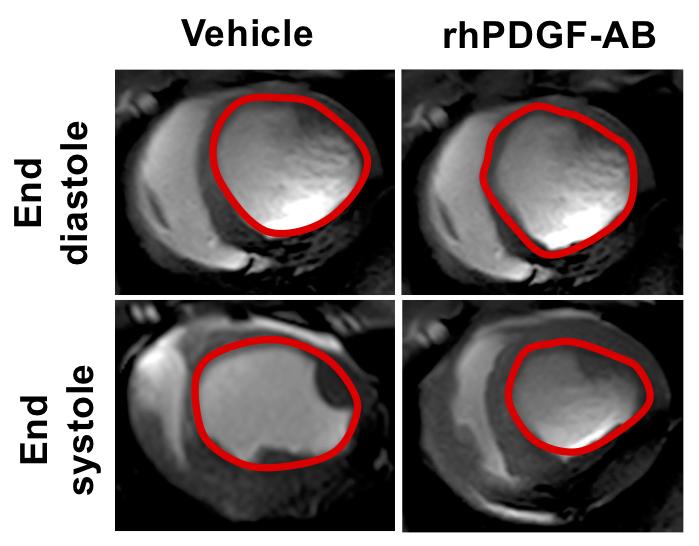 Repair Treatment For Heart Attacks Advances T | EurekAlert!