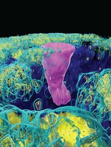 Illustration of pulmonary ionocyte in an airway