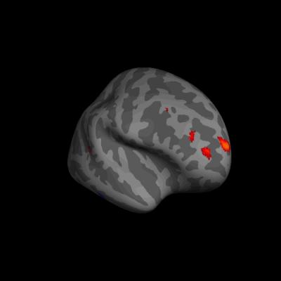Brain Matter Linked to Introspective Thoughts