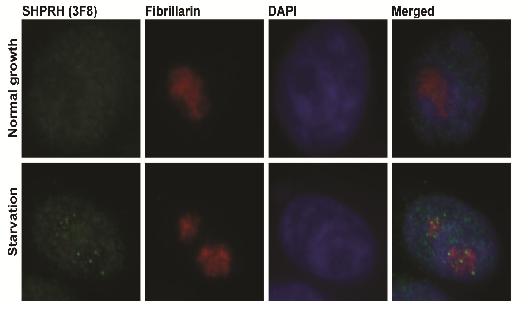 Localization of the SHPRH Protein inside Cellular Nucleus