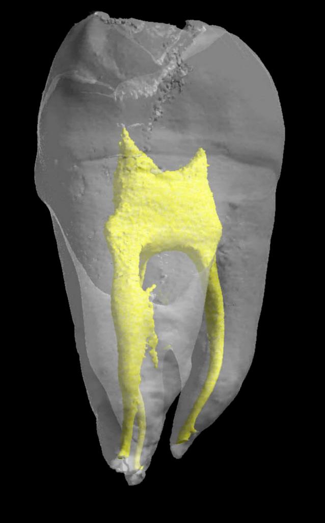 3-D Model of a Tooth
