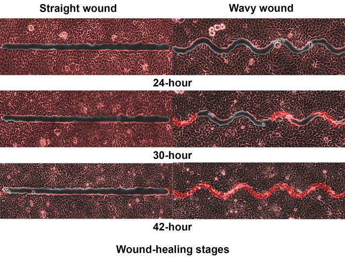 NTU Singapore scientists discover why wavy wounds heal faster than straight wounds