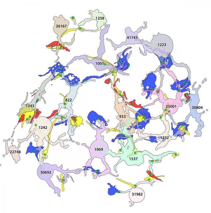 2-D pathoconnectome image: Rod bipolar cell dendrites