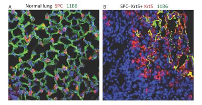 Stem Cells Repair Lung Damage After Flu Infection