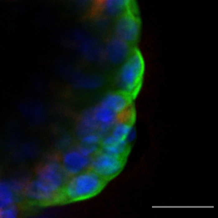 Bile duct/liver organoid infected with SARS-CoV-2