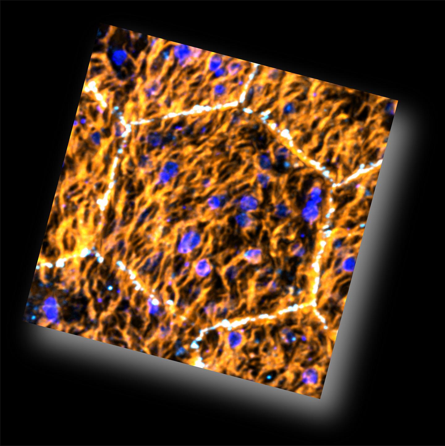 Cells of the Retinal Pigment Epithelium