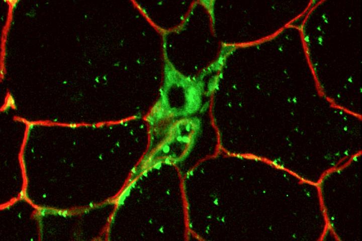 Fatty Acid Synthesis and Inflammation