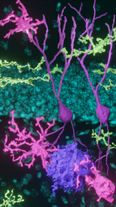Les scientifiques améliorent de nouveaux neurones pour restaurer la mémoire