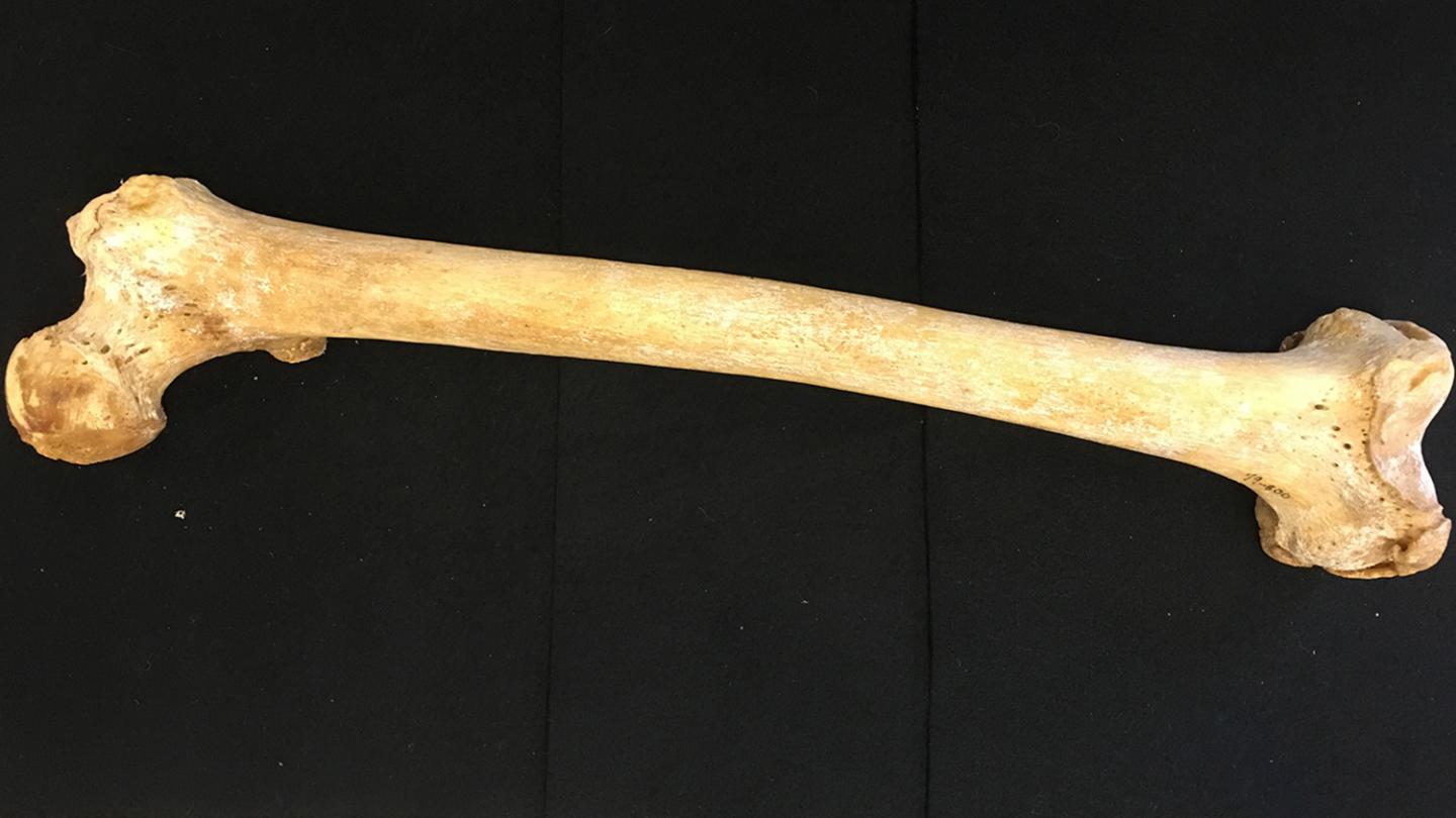 Forensic Scientists Find Femur Allows For More Accurate Estimate of Age