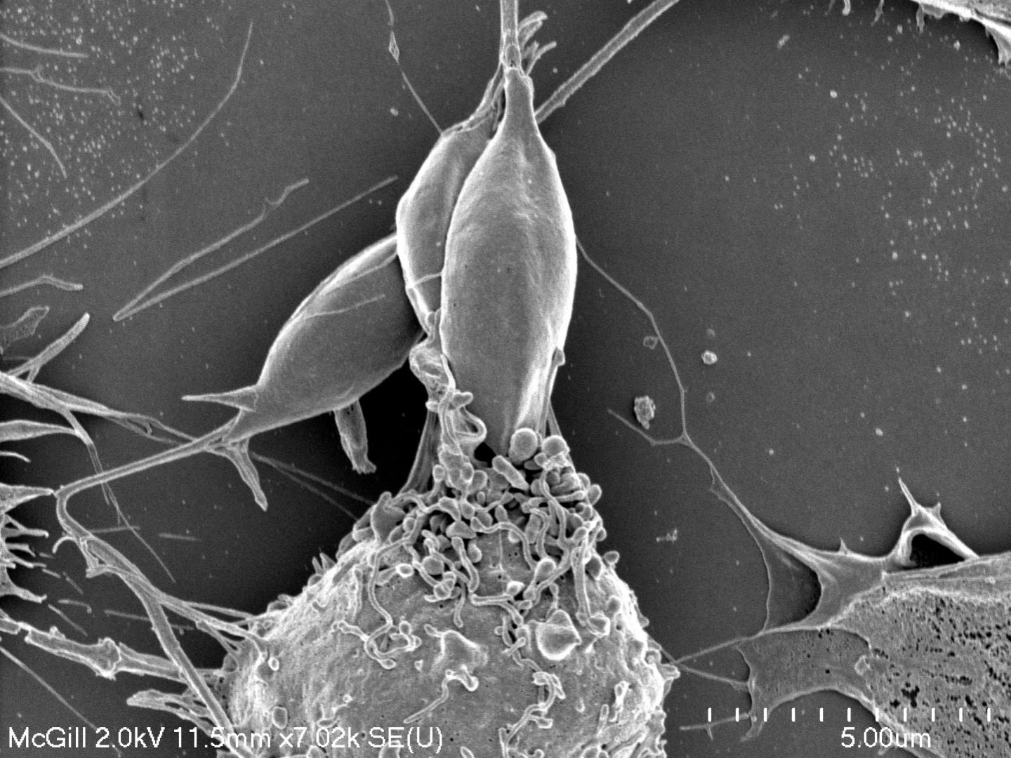 Parasite <i>Leishmania</i> Being Ingested by a Macrophage