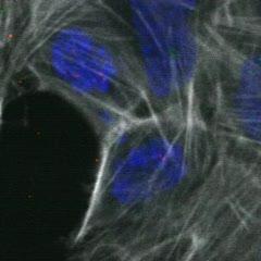 Chromosome Segregation Errors Provide Two Routes to Tumors (1 of 3)