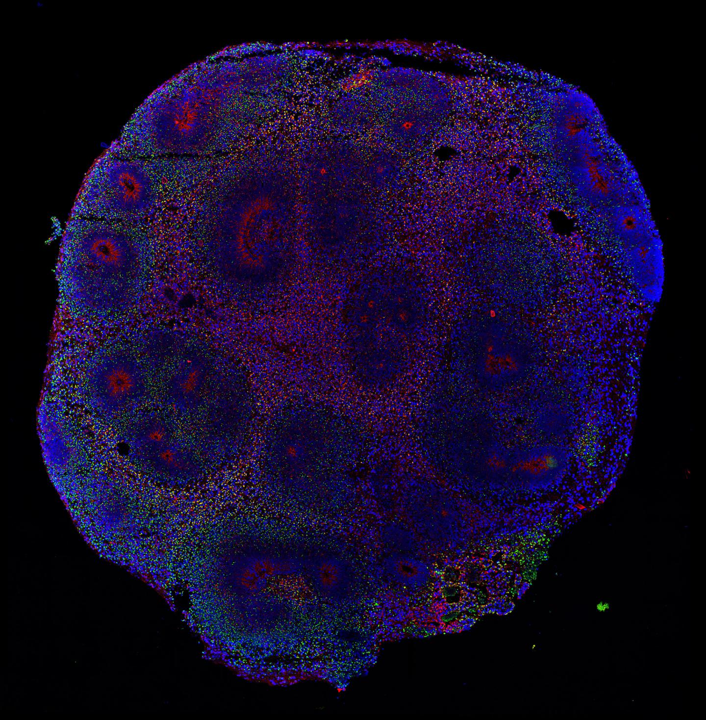 Brain Organoid Infected by the Zika Virus